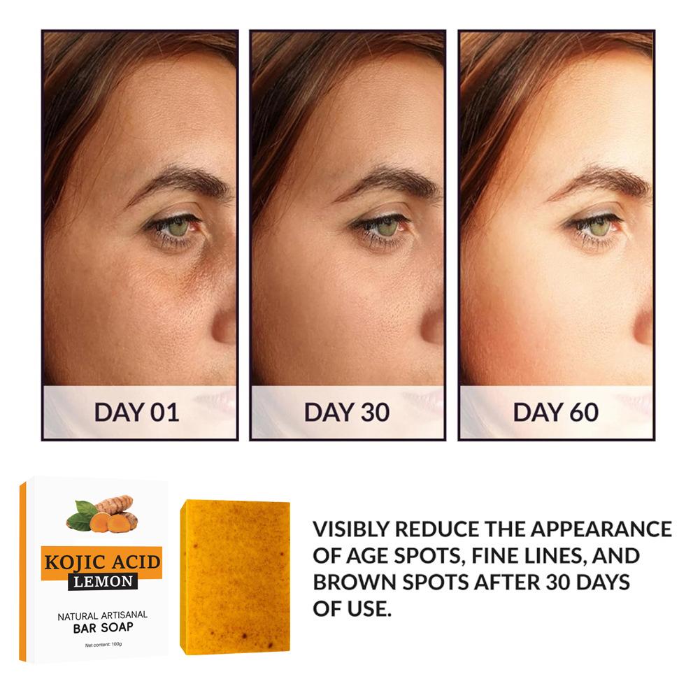 Newly upgrade Turmeric Kojic A - đánh giá và giá Kojic Acid Soap