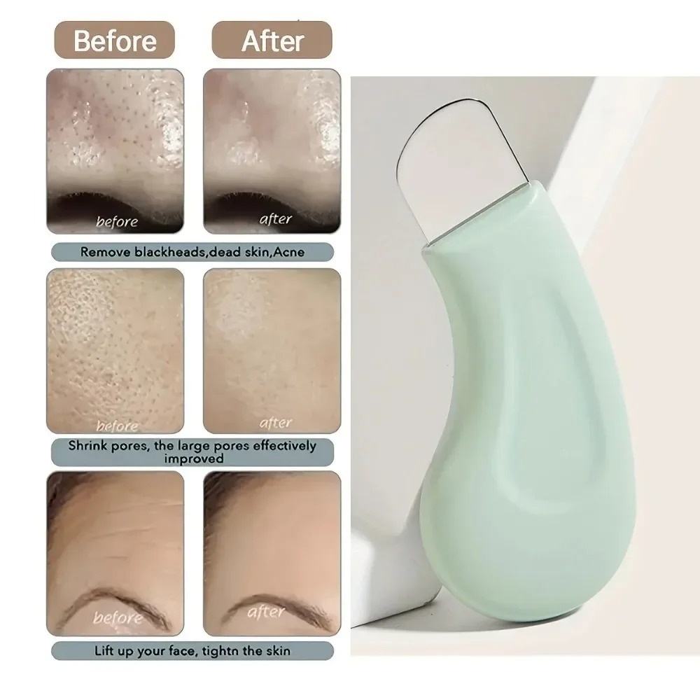 Deep Cleansing Blackhead White - đánh giá và giá Skincare Routine
