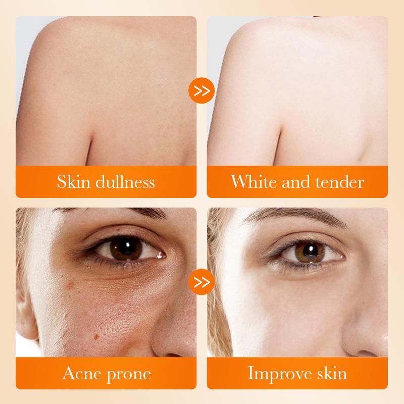 1Pc SADOER Kojic Acid Facial S - đánh giá và giá Kojic Acid Soap
